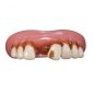 Quarterbuck Cavity Teeth